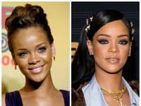 Speváčka Rihanna pred, a po úprave nosa