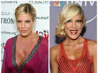 Herečka Tori Spelling pred, a po úprave nosa