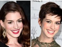Anne Hathaway pôsobí s krátkym účesom oveľa staršie
