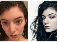 Speváčka Lorde si je vedomá svojich nedostatkov, rovnako ako aj toho, že je photoshopom väčšinou vyretušovaná