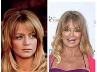 Rovnakým prípadom je aj matka Kate Hudson, taktiež herečka Goldie Hawn