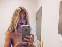 Modelka Elsa Hosk prekvapuje pikantnými fotografiami