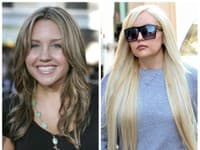 Amanda Bynes podstúpila plastickú operáciu keď mala 27 rokov