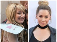 Ashley Tisdale si dala spraviť nos v už v 22-ke