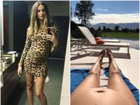 Behati Prinsloo sa už teší z rastúceho bruška