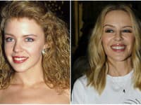 Speváčka Kylie Minogue vyzerá neskutočne dobre