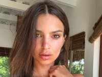 Modelka Emily Rajkowski svojou žiarivou pleťou ohuruje nielen počas leta