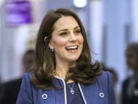 Nielen britský denník Dailymail, ale aj ďalšie sa tejto malej kuriozity na tele vojvodkyne Kate chytili