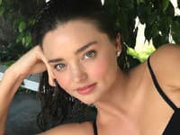 Modelka Miranda Kerr má vo svojej starostlivosti o pleť tajné triky či beauty rituály, vďaka ktorým vyzerá stále mlado a sviežo