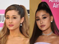 Mladá speváčka, Ariana Grande, je jednoducho prototypom krásnej tváre samej o sebe. Má však aj ona korekciu tváre?