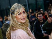 Neprehliadnuteľný trend sezóny - hair clips alebo tzv. “sponky”