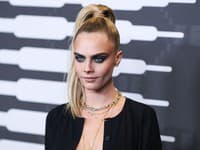 Cara Delevigne má tiež svoje nedostatky