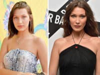 Bella Hadid čelí často kritike kvôli nepriznaným plastickým operáciám