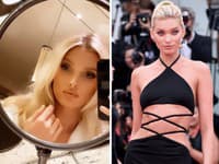 Topmodelka Elsa Hosk sa tiež rada vylepší