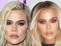 Úprava fotiek Khloe Kardashian bije do očí