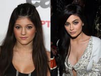 Premena Kylie Jenner je naozaj výrazná
