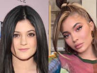 Kylie sa rokmi skutočne zmenila