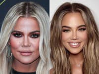 Khloe Kardashian to s retušou neskutočne preháňa