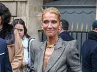 Bojuje s anorexiou? Postava známej celebrity nikdy nevyzerala horšie