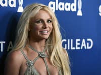 Britney Spears si prešla viacerými úpravami