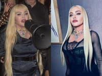 Madonna to v poslednej dobe s filtrami viditeľne preháňa