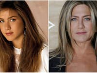 Takto vyzerala Jennifer Aniston pred a po úprave nosa, ktorú podstúpila až dvakrát. 