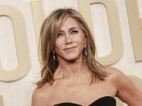 Herečka Jennifer Aniston otvorene porozprávala o zákrokoch a vylepšeniach  na svojom tele. 