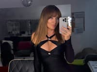 Myslíte si, že to Alexandra Orviská s úpravami svojho zovňajšku už preháňa