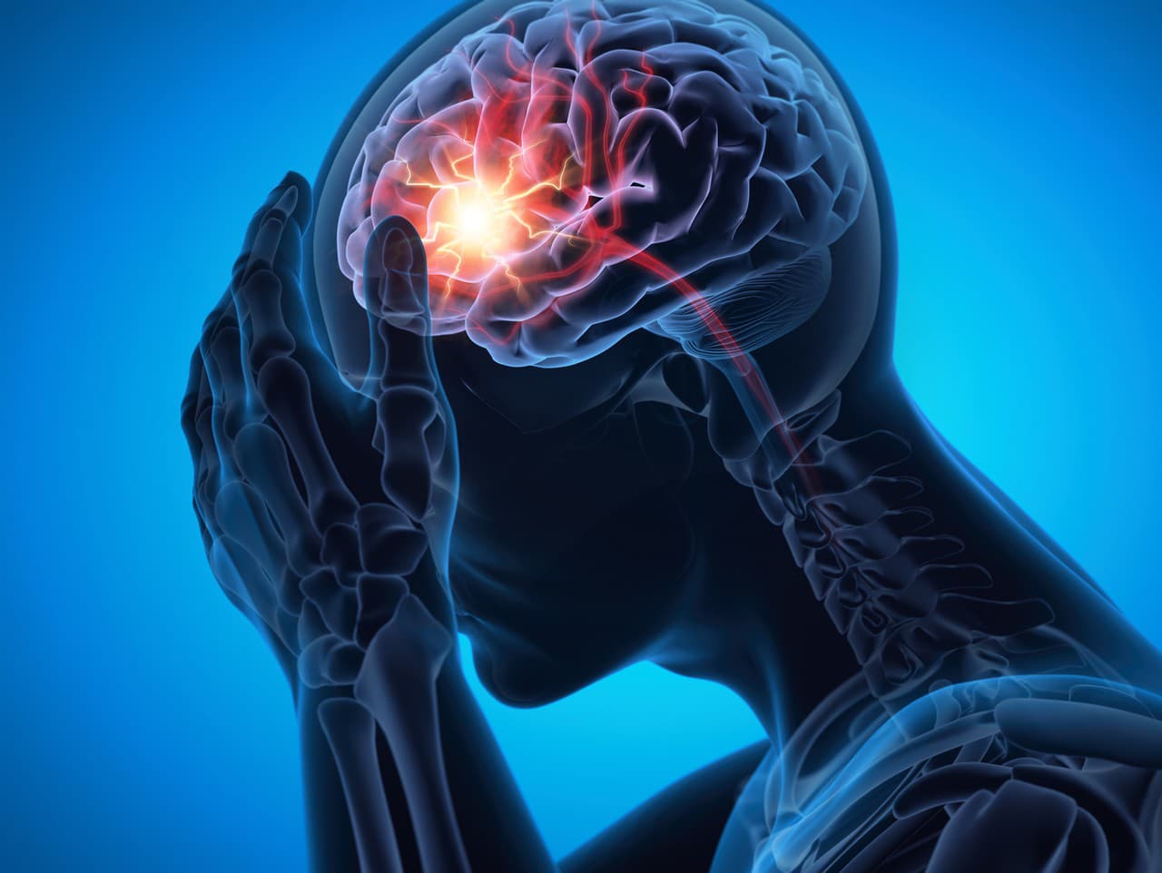 Ilustračný obrázok