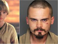  Jake Lloyd ako Anakin Skywalker a dnes