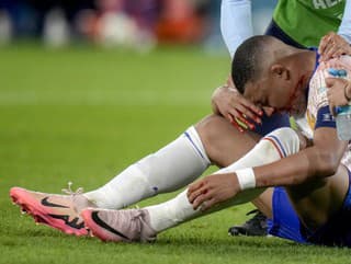 Kylian Mbappé s krvavým