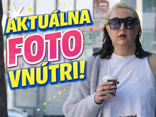 Herečka Amanda Bynes výrazne
