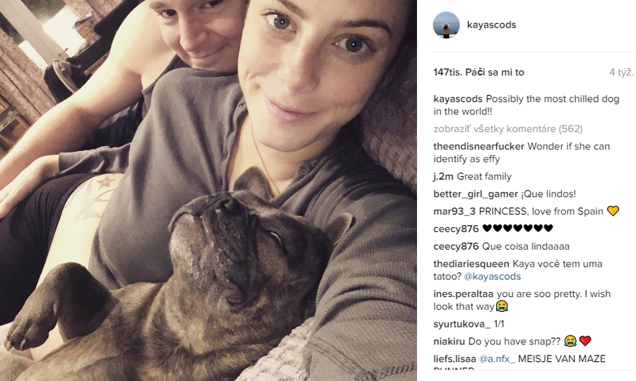 Anglická kráska porodila chlapčeka: