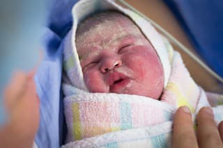 Novorodenecký VERNIX: Prečo ho