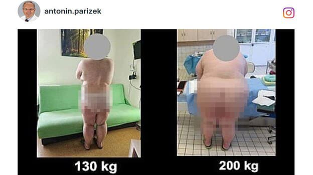 Fotografie tehotných žien