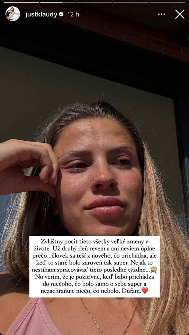 Známa slovenská influencerka ČOSKORO