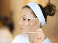Ako ZOSVETLIŤ pokožku bez návštevy kliniky? Pigmentové ŠKVRNY môže odstrániť PRÍRODA