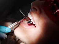 Zapálené ďasná neškodia len ústnej dutine: V ohrození je tento dôležitý ORGÁN v tele!