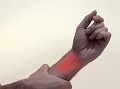 Brnenie v prstoch či nohách spôsobuje útlak nervu. Viete ale, kedy symbolizuje vážnejšie ochorenie? 