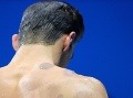 Červené kruhy na chrbte Michaela Phelpsa nie sú ničím výnimočným (zdroj: profimedia.sk) 