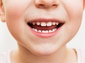 Najčastejším chronickým ochorením detí a mládeže je zubný kaz.