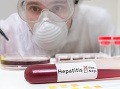 Vírusová hepatitída je zápalové ochorenie pečene, pri ktorom dochádza následkom vírusovej infekcie k poškodeniu alebo až zániku buniek pečene.