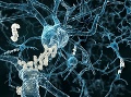Beta-amyloidné plaky pri Alzheimerovej chorobe. Foto: Gettyimages.com