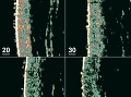 Kožné vlákna pod sonografom podľa veku. Zdroj foto: Pharex