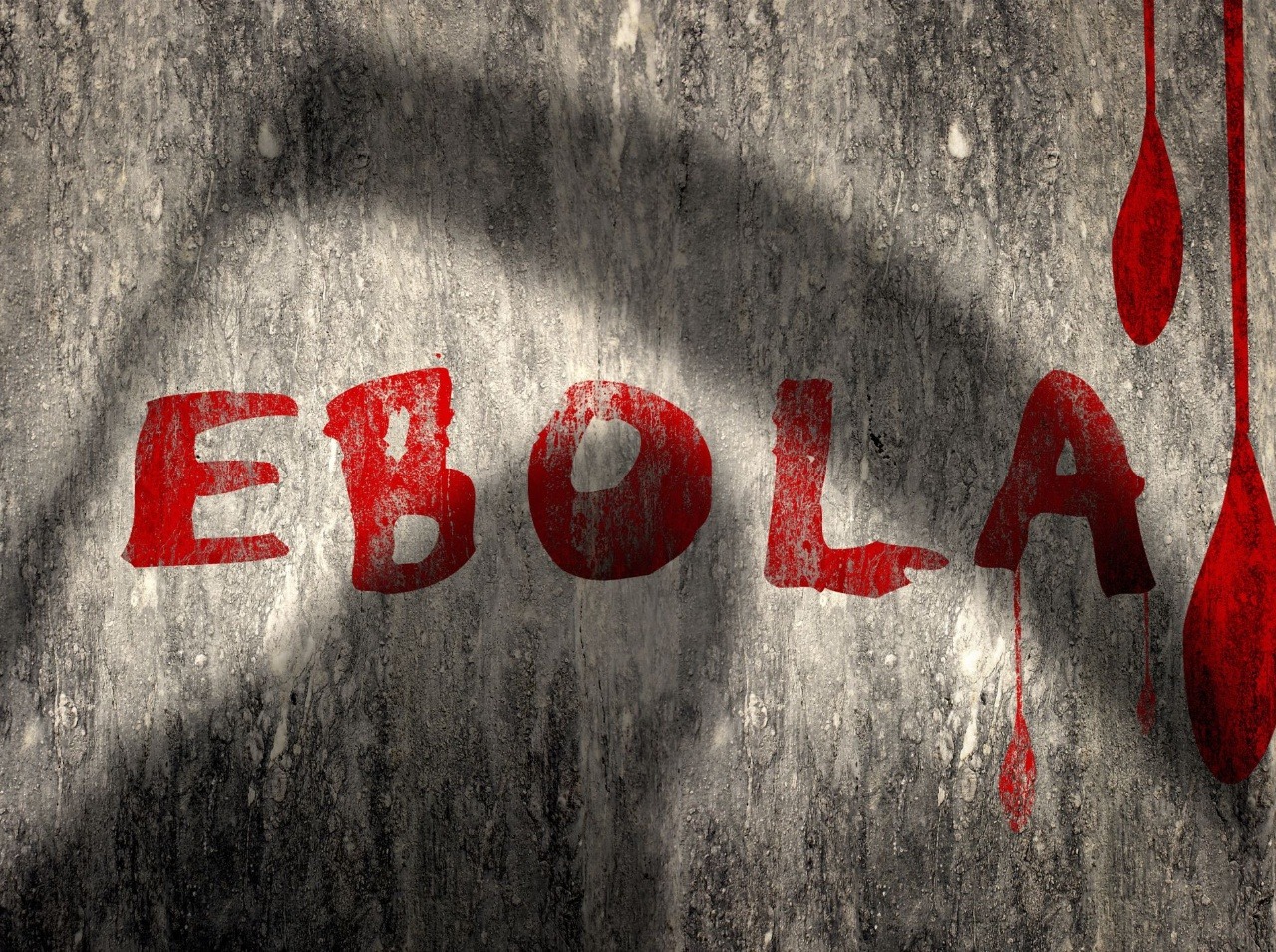 Ebola stále zúri vo svete a berie si ľudské životy!