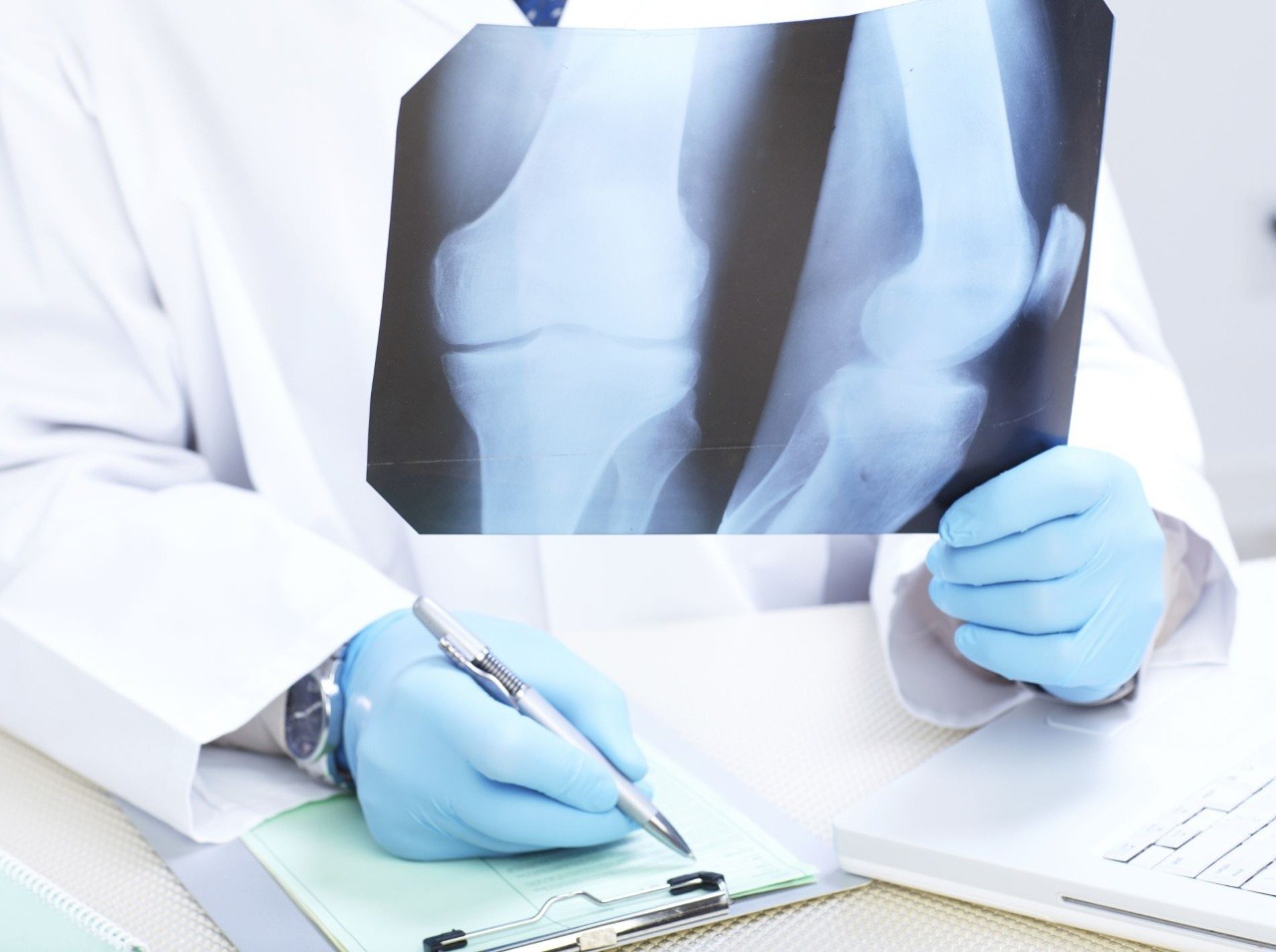 Liptovská nemocnica uviedla do prevádzky nový digitálny röntgen. (Ilustračná fotografia)