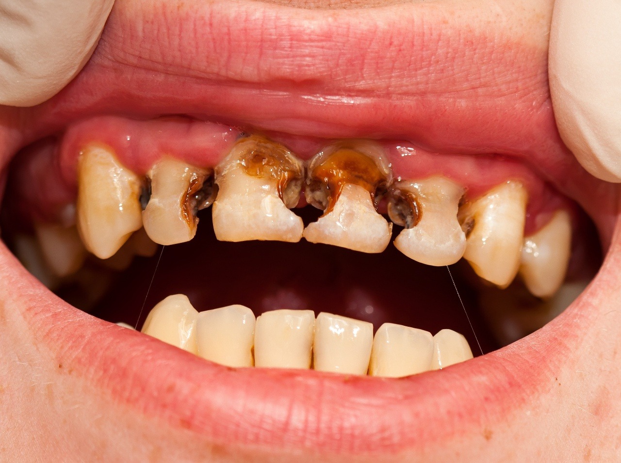 Ak máte problémy so zubami, nevynechajte návštevu zubára!