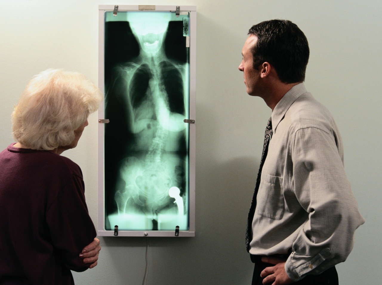 Žena išla na vyšetrenia a röntgen odhalil neuveriteľný nález v jej tele! (Ilustračná forografia)