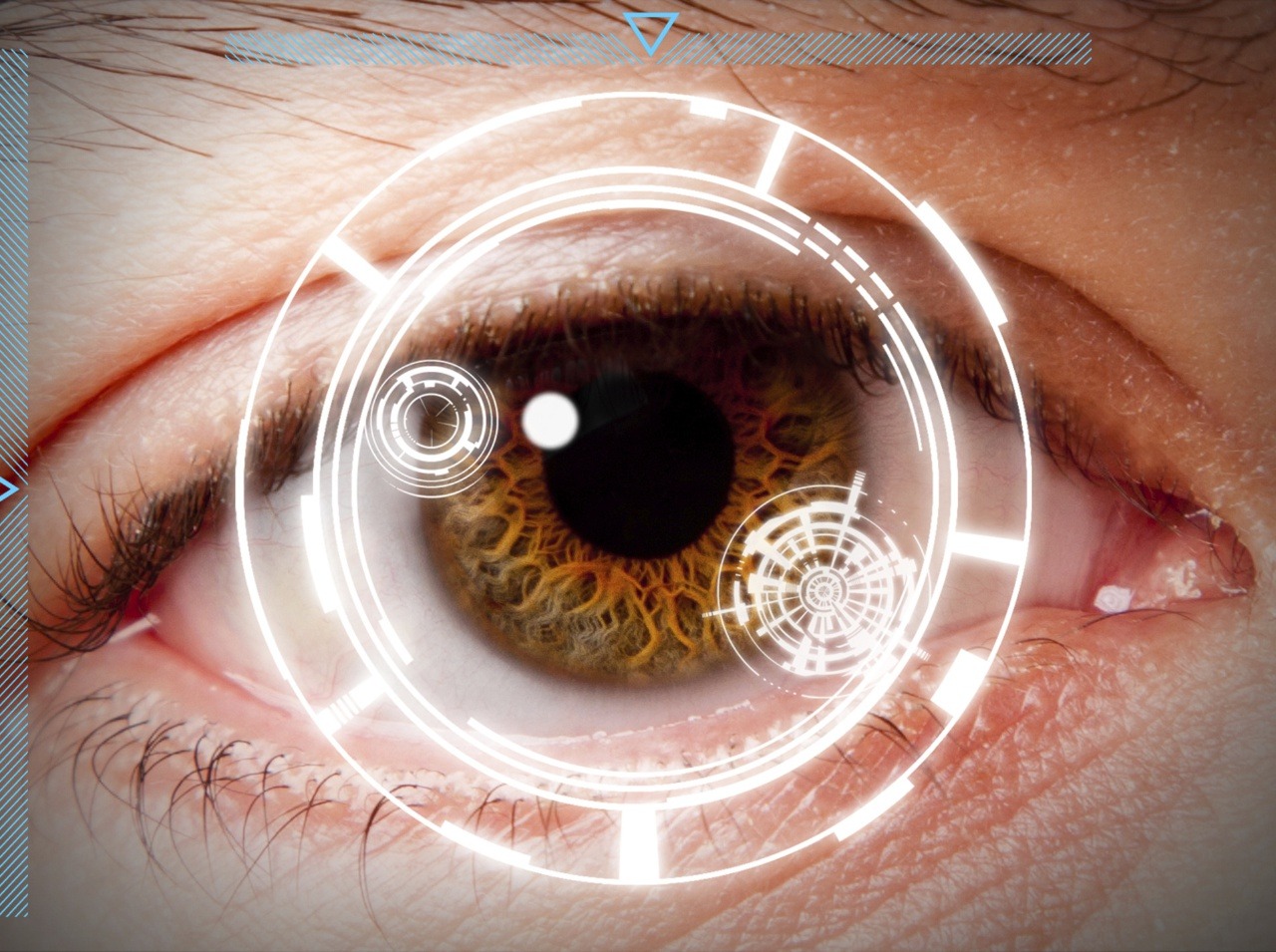 Očný lekár pomôže cukrovkárom zabezpečiť zdravý zrak, v niektorých prípadoch dokonca môže samotnú cukrovku odhaliť! 