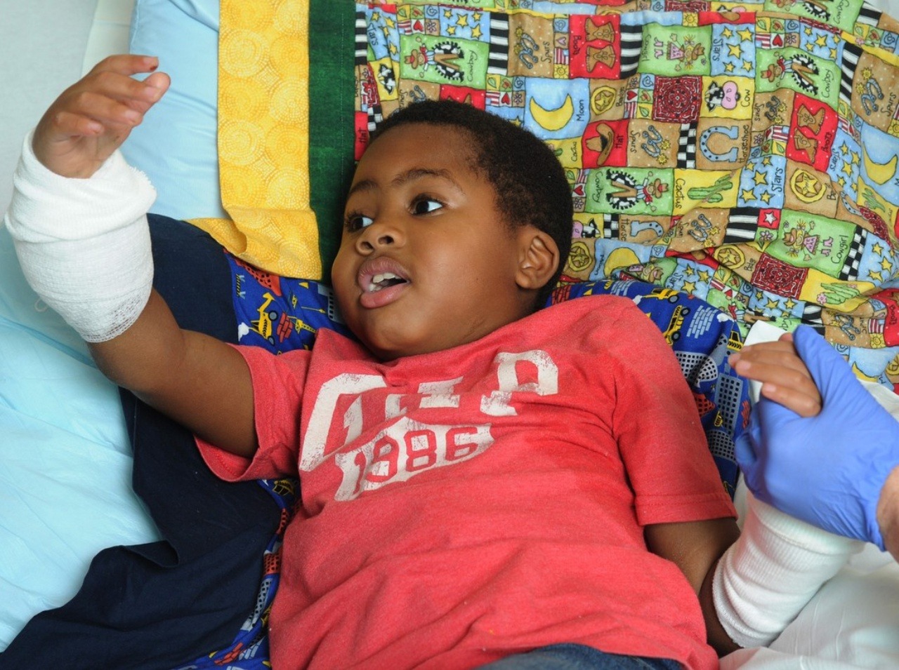 Zion sa stal vôbec prvým dieťaťom na svete, ktoré podstúpilo transplantáciu rúk.